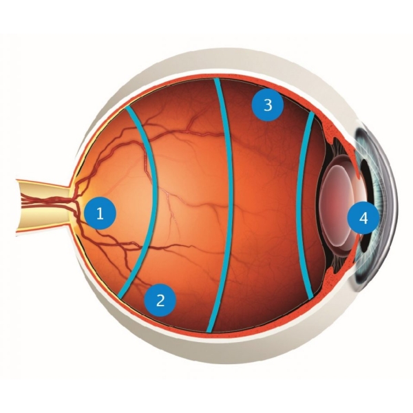 Disposable Three Mirror Lens - Image 2